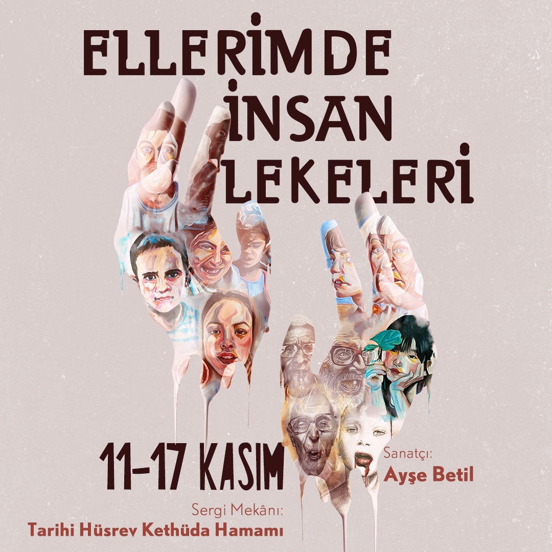 ELLERİMDE İNSAN LEKELERİ